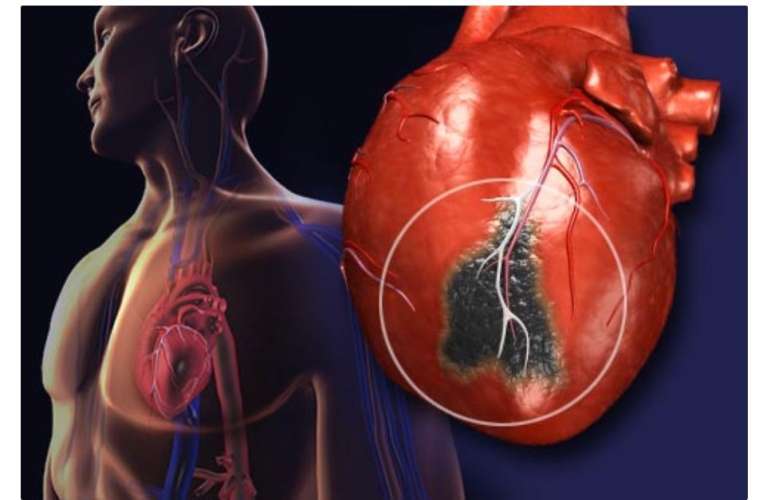 Byinshi muri byo bifatwa nk'ibisanzwe: Ibintu 7 byangiza cyane umutima ukwiye kwirinda cyane