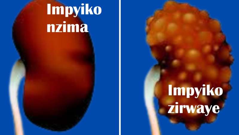 Niba nawe ukora ibi menya ko urimo wihamagarira urupfu😭 Dore ibintu 7 byangiza impyiko cyane abantu bakunze gukora batabizi