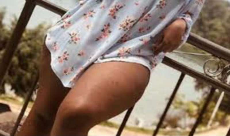 Si ngombwa kujya kwa muganga: Ibintu 5 byagufasha kugira amavangingo menshi cyane udakoresheje imiti