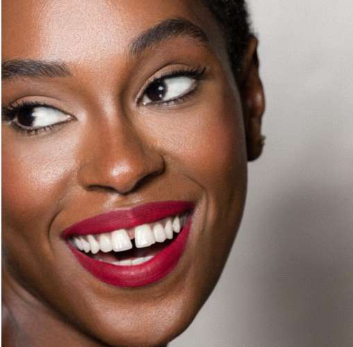 Ngiki igisobanuro cy'inyinya zigirwa na bake kuri iyi si ndetse n'ibiranga abazifite