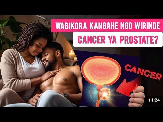 DORE INSHURO UMUGABO AGOMBA GUKORA IMIBONANO MPUZABITSINA KUGIRA NGO YIRINDE #CANCERYAPROSTATE  - IBIVUGWA N'IBITAVUGWA
