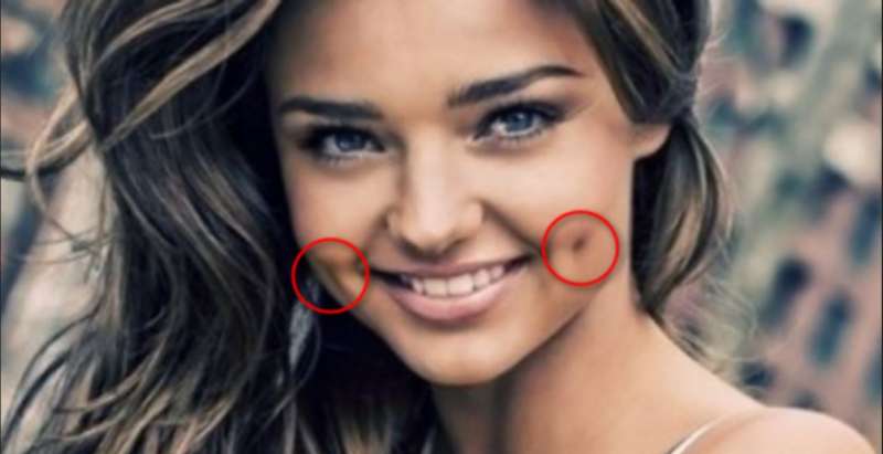 Inkomoko ya Fossettes(Utwobo tuza ku matama akenshi iyo umuntu asetse) ndetse n&rsquo;igisobanuro cyazo