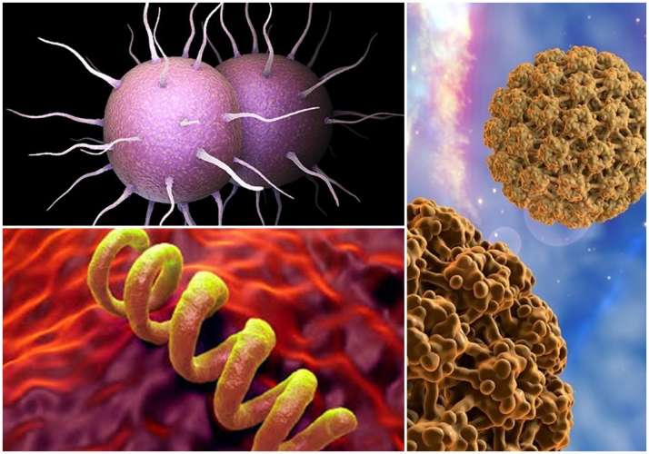 Waba wakoresheje agakingirizo waba utagakoresheje urazandura😨 Indwara 5 mbi cyane zandurira mu mibonano mpuzabits1na abantu benshi batazi