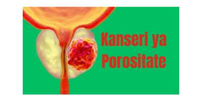 Sobanukirwa Kanseri(Canser) ya prostate(Kanseri y'amabya), ibimenyetso byayo, uko wayivura n&rsquo;uko wayirinda