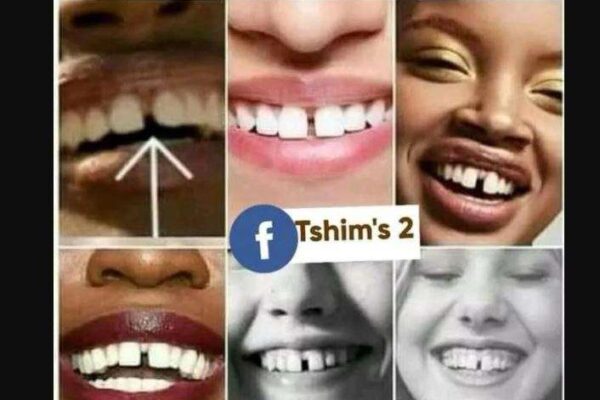 Igisobanuro cy’inyinya n’uko abazifite bitwara