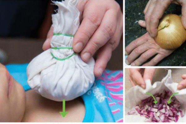 Dore indwara 10 zivurwa n’igitunguru ndetse n’uko gikoreshwa mu kwivura