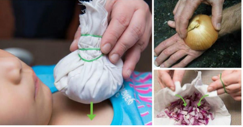 indwara zivurwa n'igitunguru gitukura