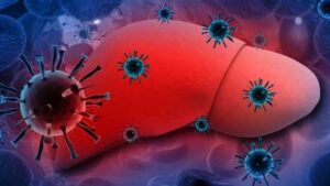 Ibimenyetso byakuburira ko urwaye Hepatite B, uko yandura n’uko wayirinda