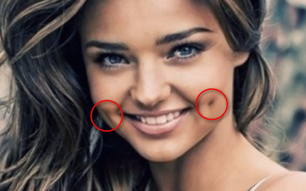 Igisobanuro cya Fossette ndetse n’uko abazifite bitwara