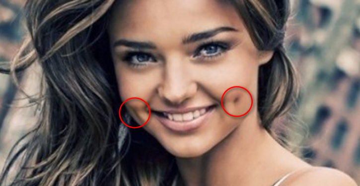 Igisobanuro cya Fossettes